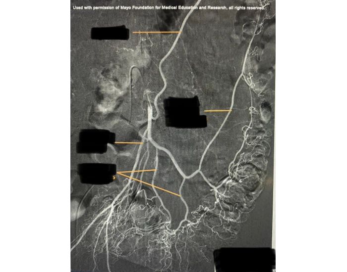 Angiogram Ir Map IR IMA Angiography (fig 1) Quiz