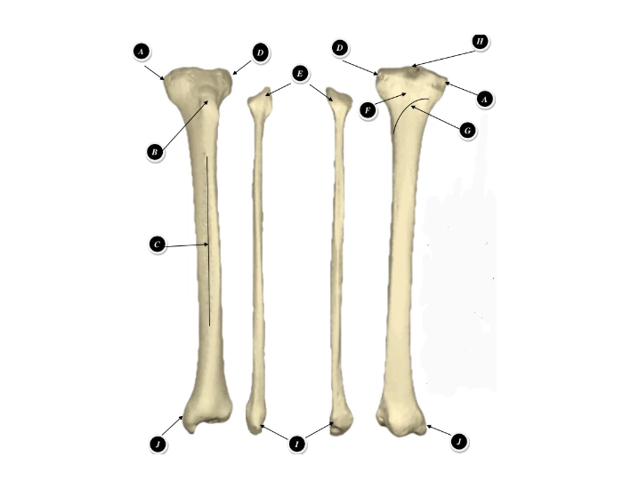 bony landmarks of tibia and fibia Quiz