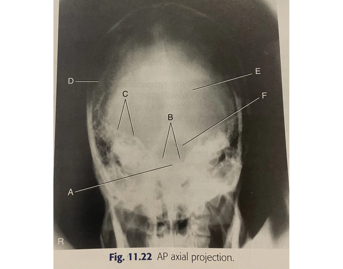 Ap Labeling AP Axial Skull Labeling — Printable Worksheet