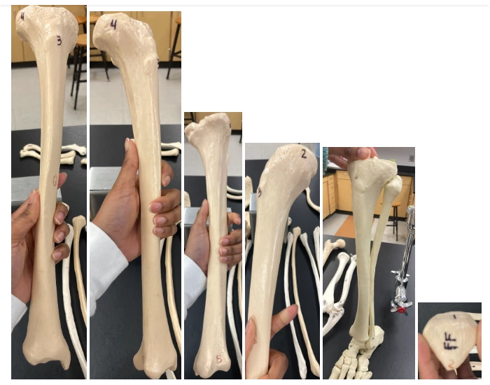 Tibia, Fibula, and Patella — Printable Worksheet