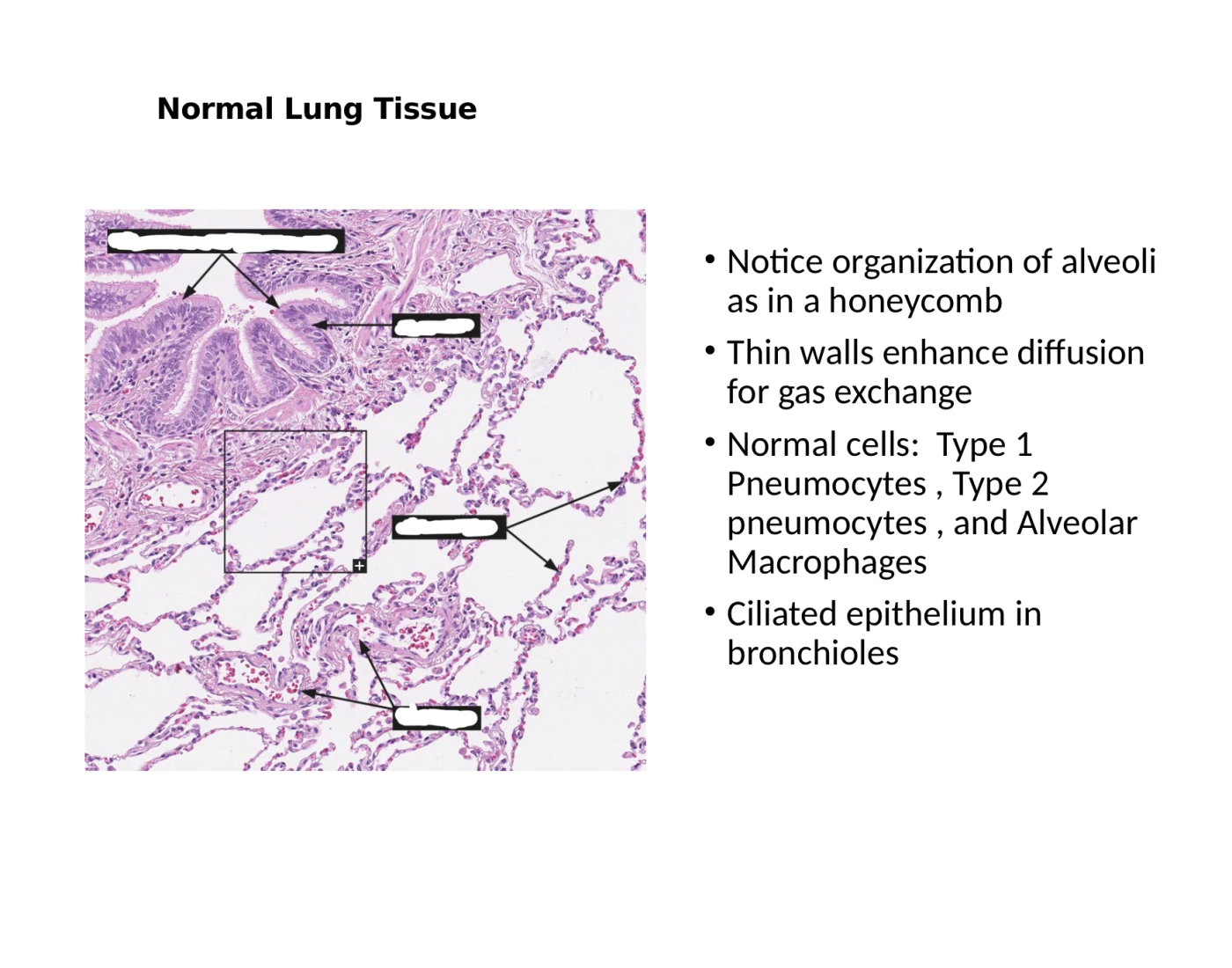 Normal Lng Normal lung tissue Quiz