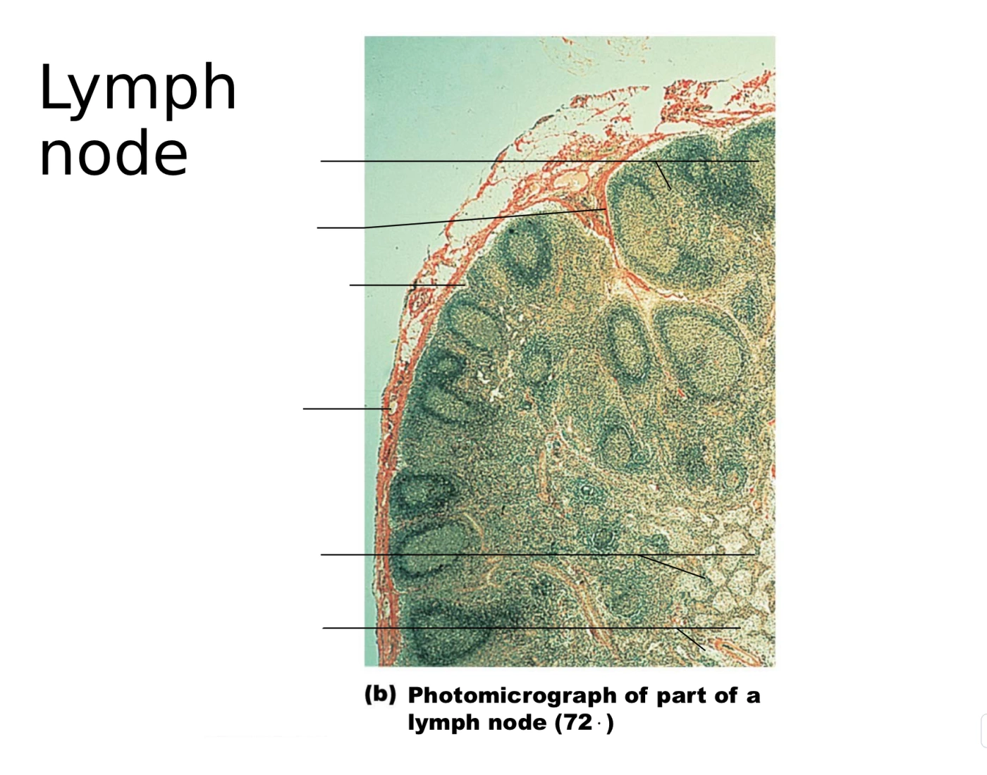Lymph Node Rfa Lymph node Quiz
