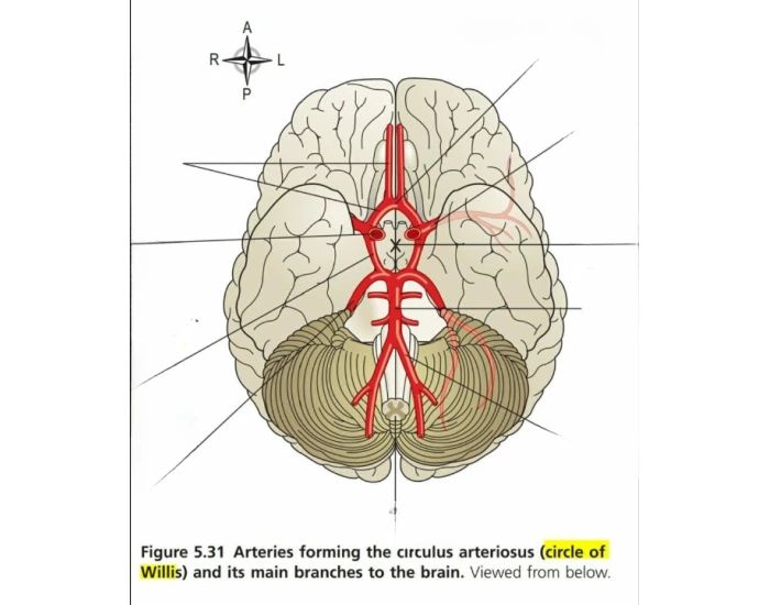 Circle of willis Quiz Circle of willis Quiz