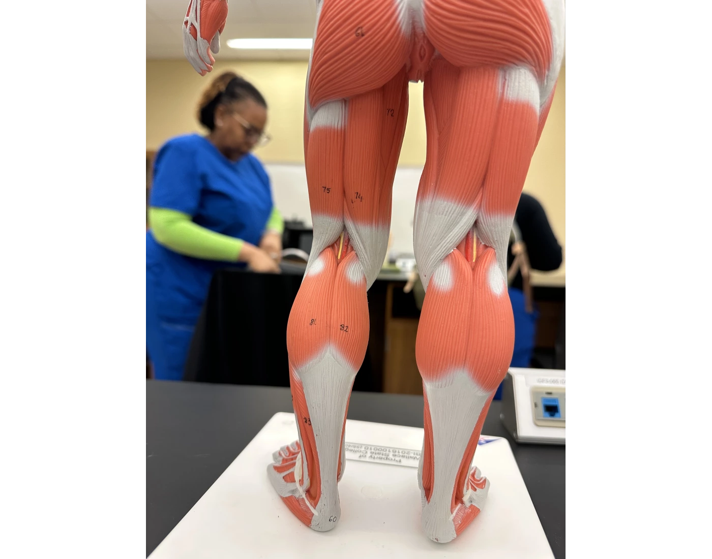 Posterior leg muscle label Quiz