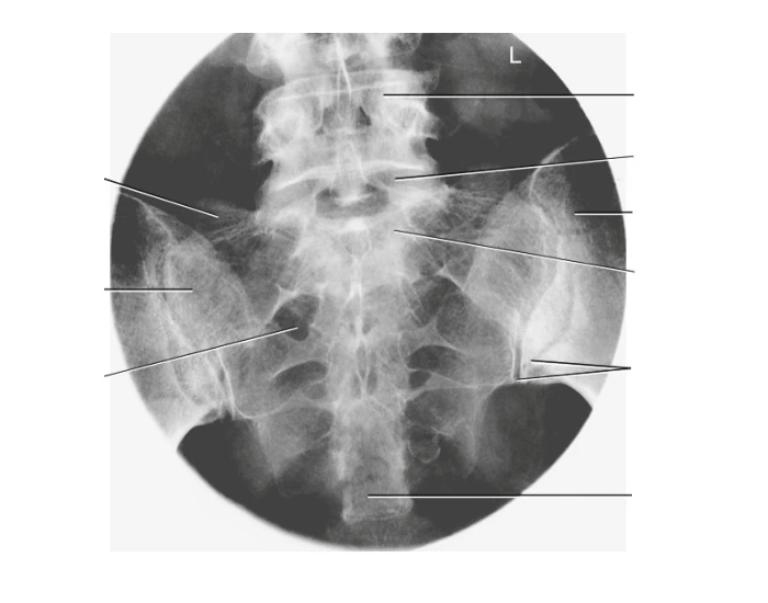 Ap Labeling AP Sacrum xry labeling Quiz