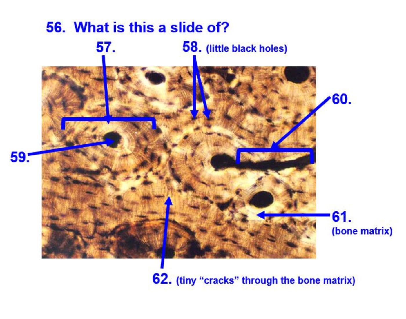 Bone Histology Quiz