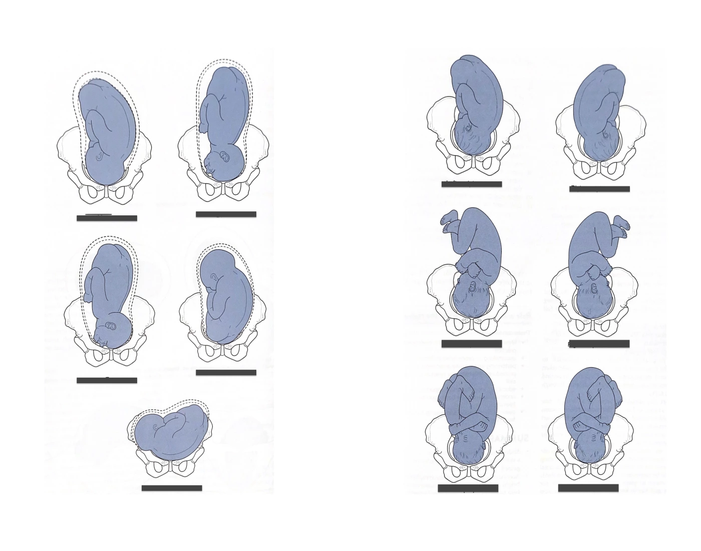 fetal presentation quiz