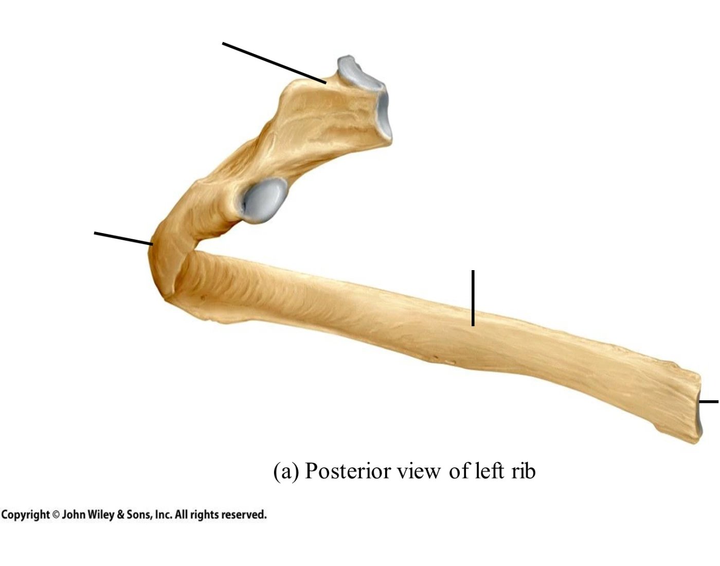 Posterior Left Rib Quiz