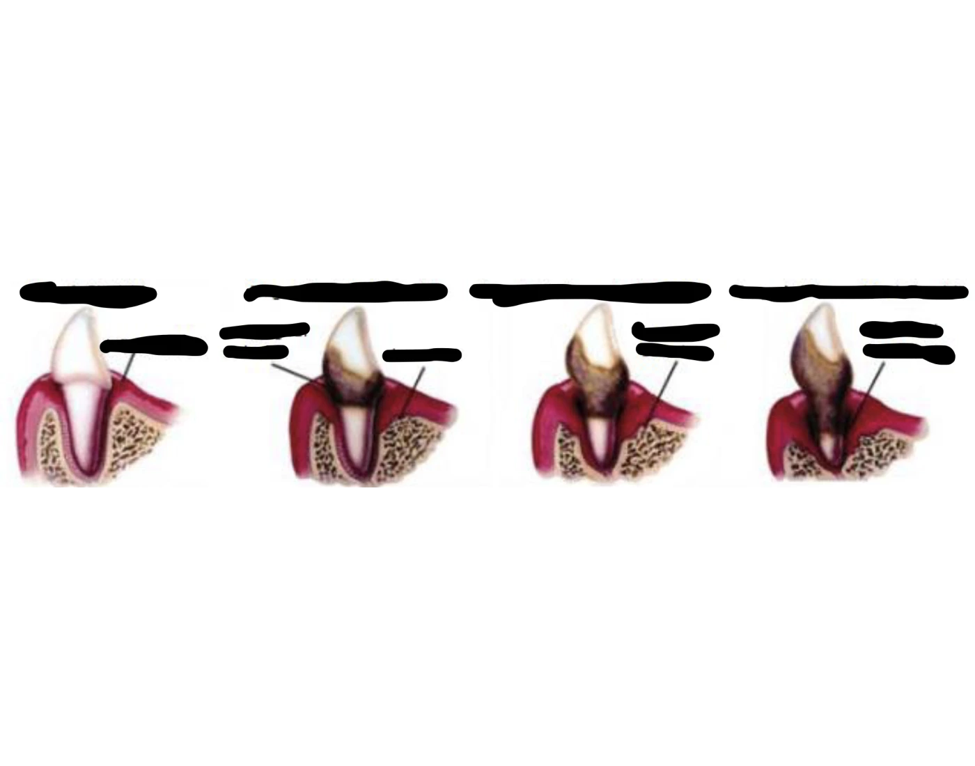 PD Stages Quiz pd-stages-quiz