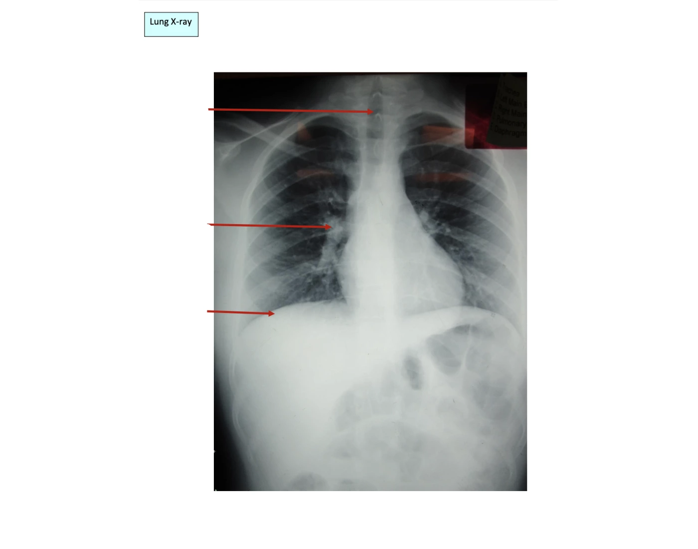 Lung X Ray Printable Worksheet