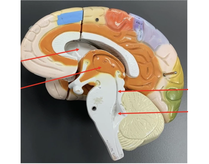CSF Pathways Quiz