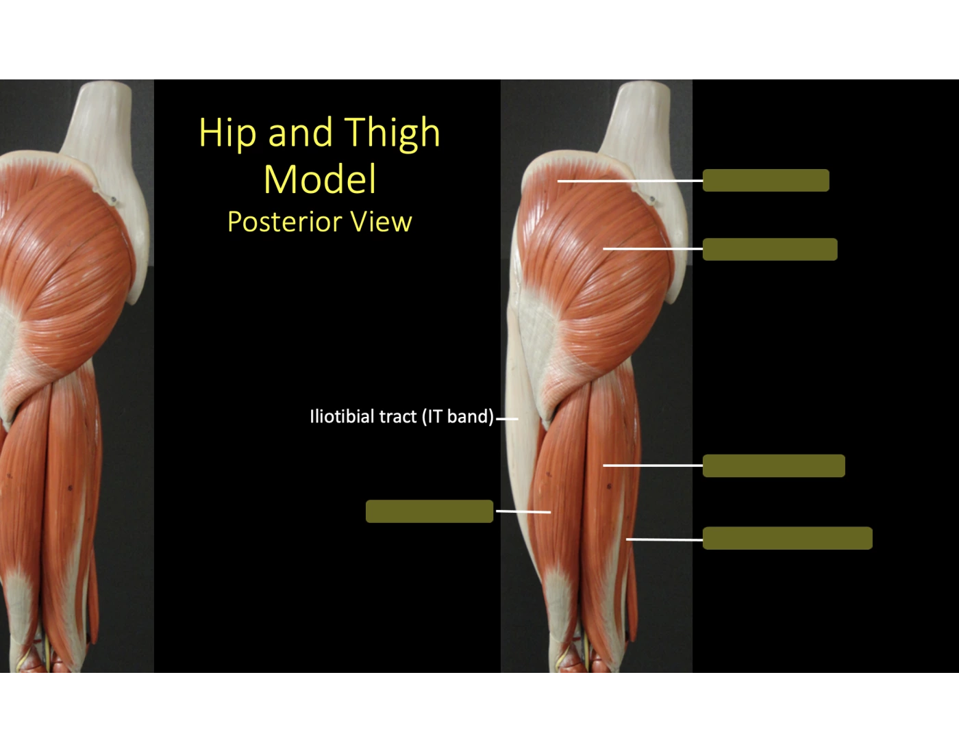 Posterior view hip/thigh — Printable Worksheet