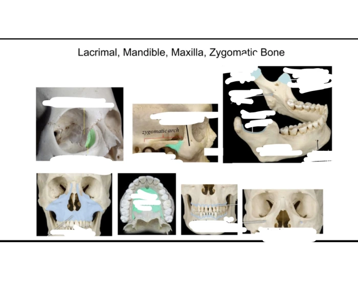 lacrimal, mandible, maxilla, zygomatic bone Quiz
