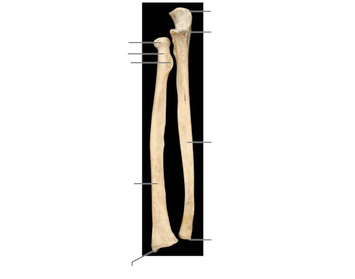 Appendicular Skeleton Radius And Ulna Printable Worksheet