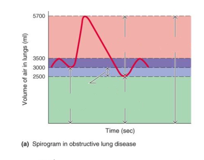 Spirogram in obstructive lung disease Quiz