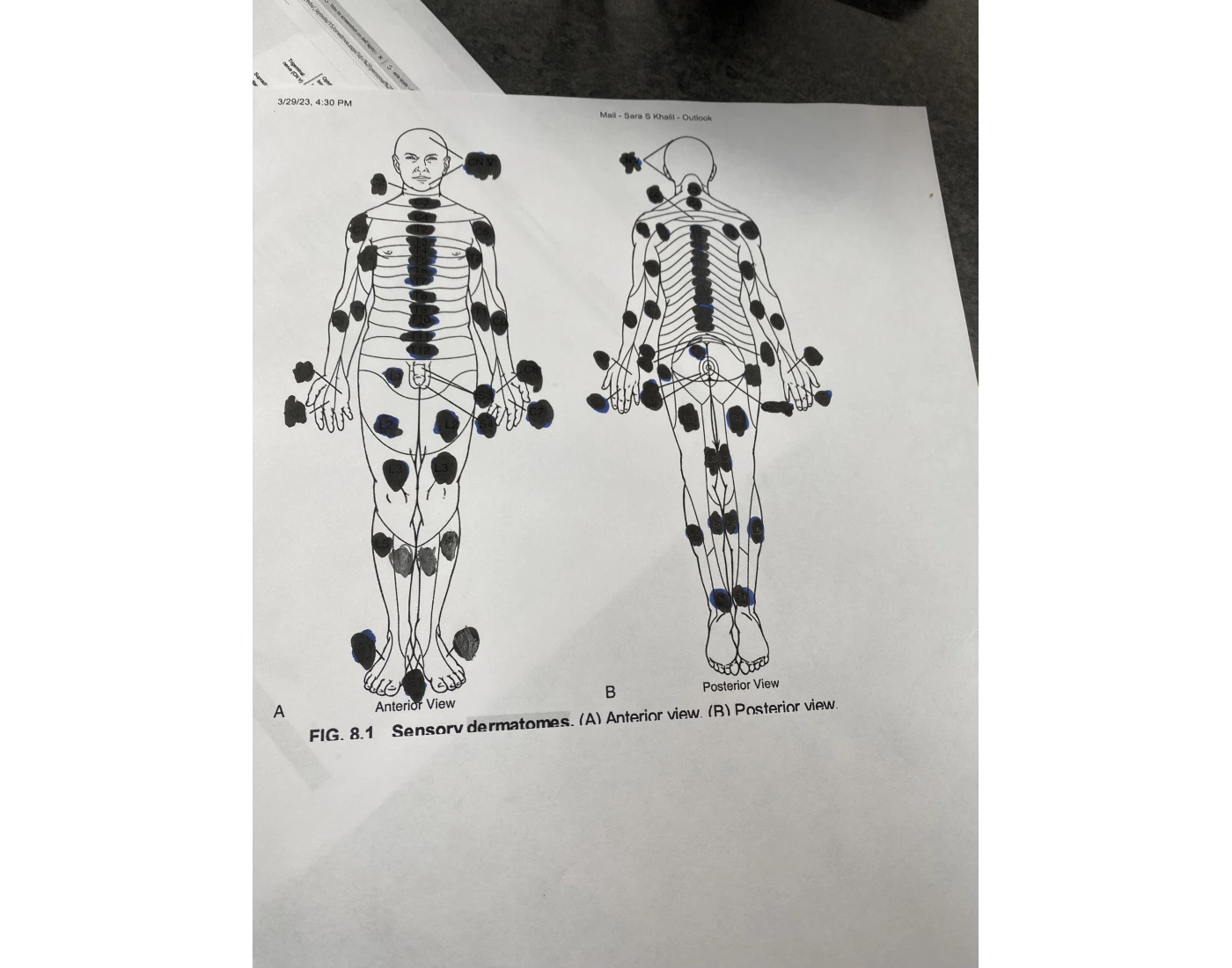 Dermatome game (ASIA scale)