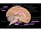 Brain (Medial View)