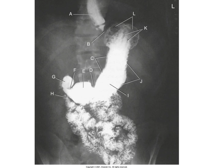 Lpo Radiography UGI - LPO xray labeling — Printable Worksheet