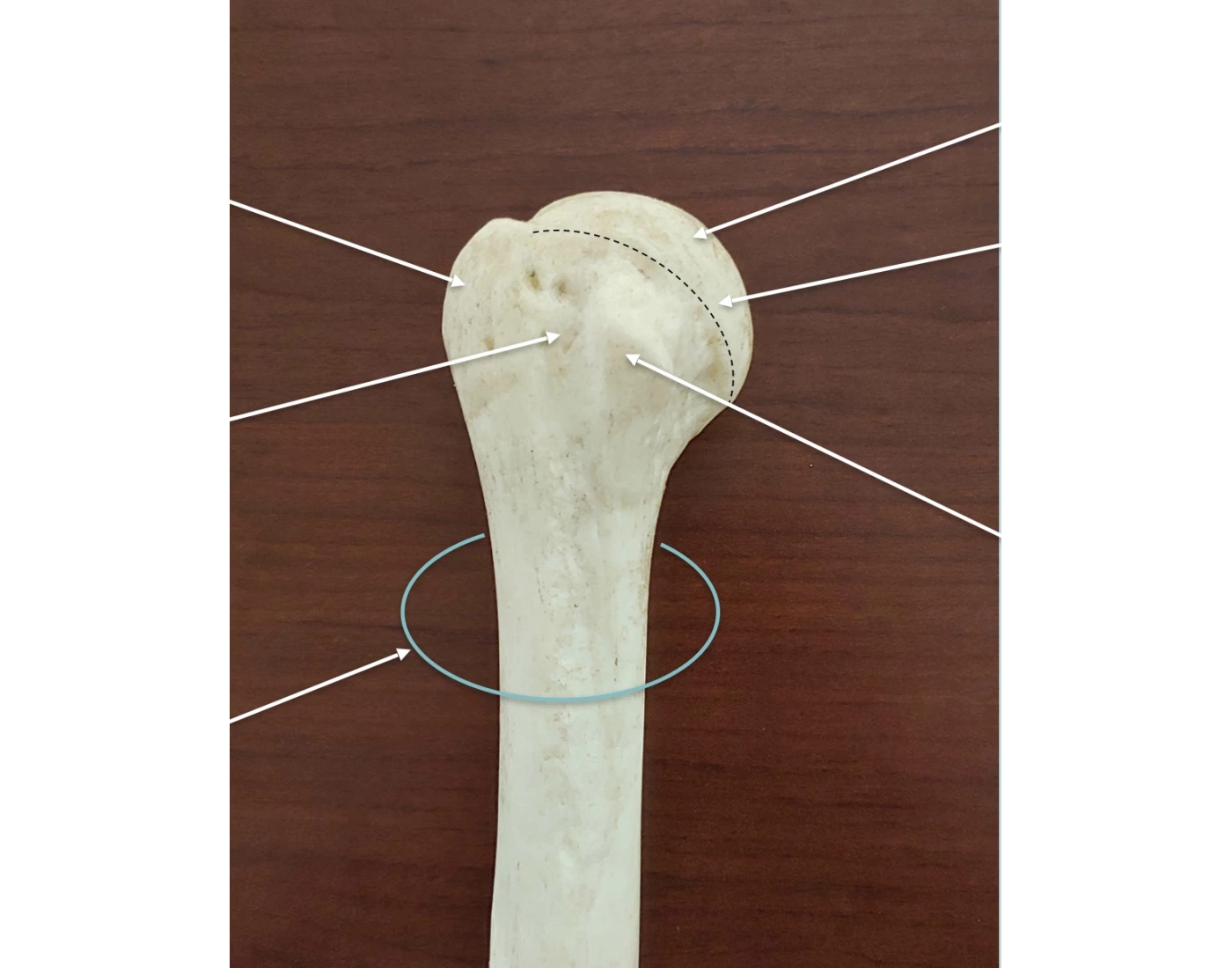 Promixol R Proximal R. Humerus - Anterior Quiz