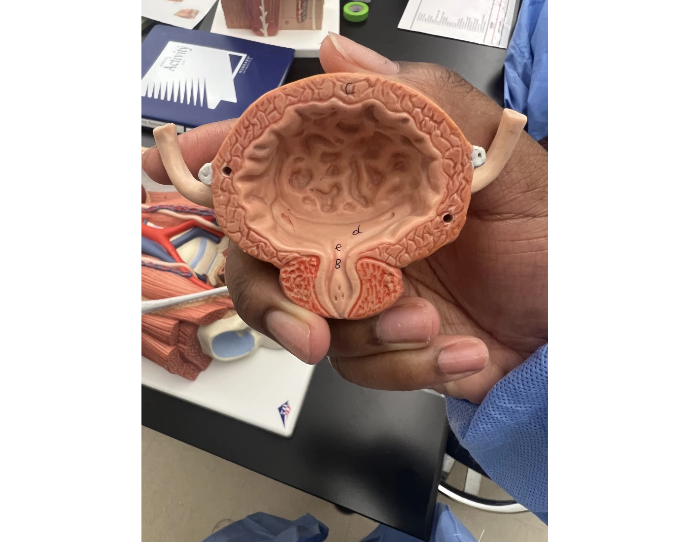 Bladder Game Bladder model Quiz