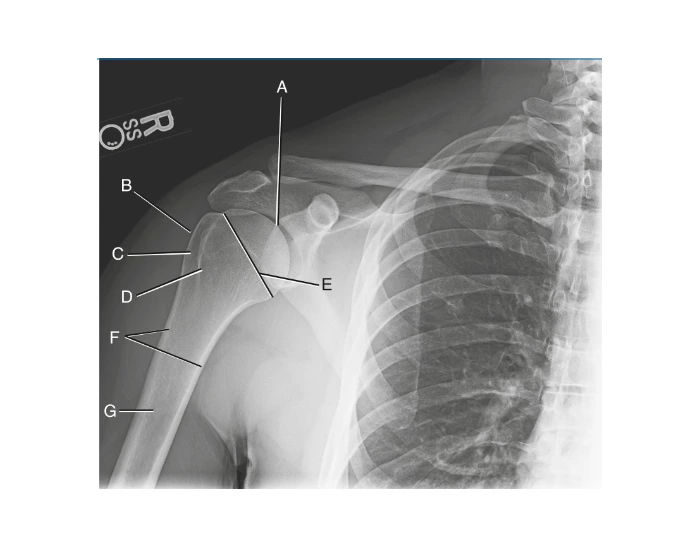 Ap Projection Neutral Rotation AP projection—neutral rotation of shoulder Quiz