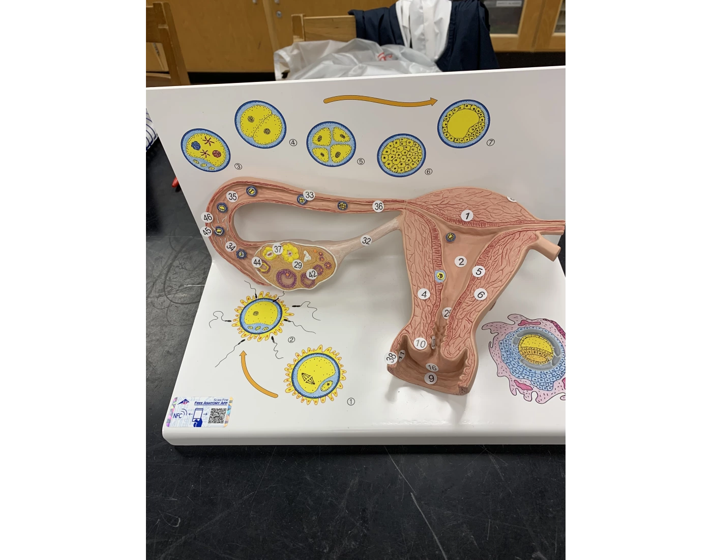 Fallopian Tube Model Label Ovarian and Fallopian Tube Model Practical 3 Quiz