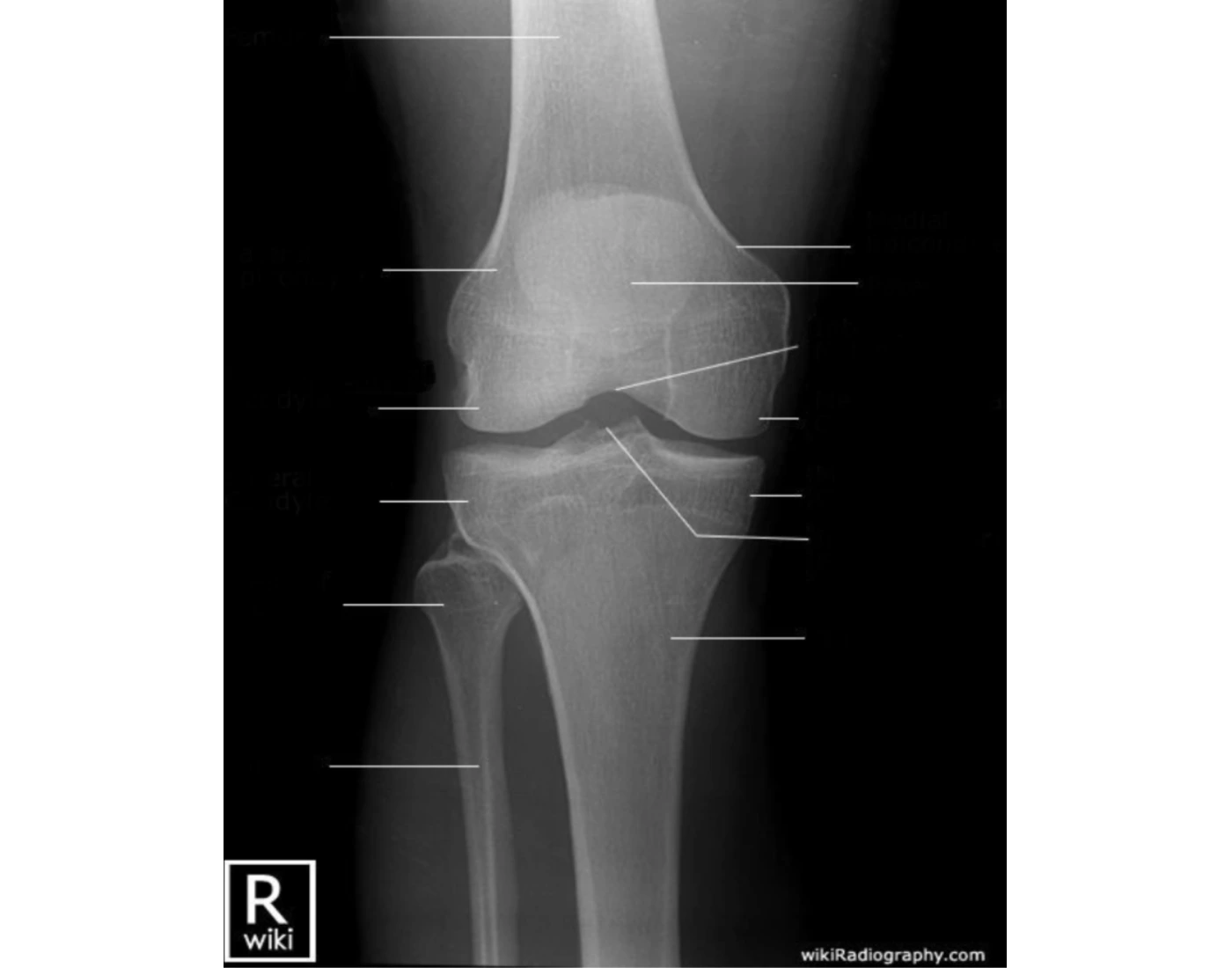 AP Knee Anatomy Quiz