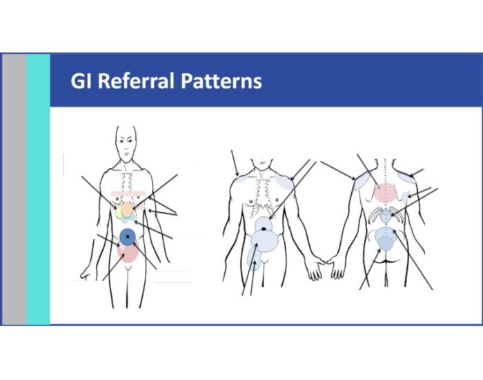 Patterned Gi Reference GI Referral Quiz