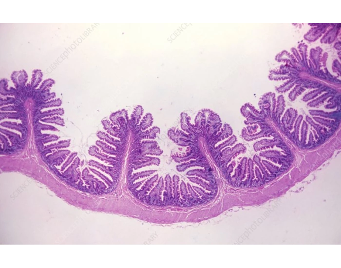 Small intestine Quiz