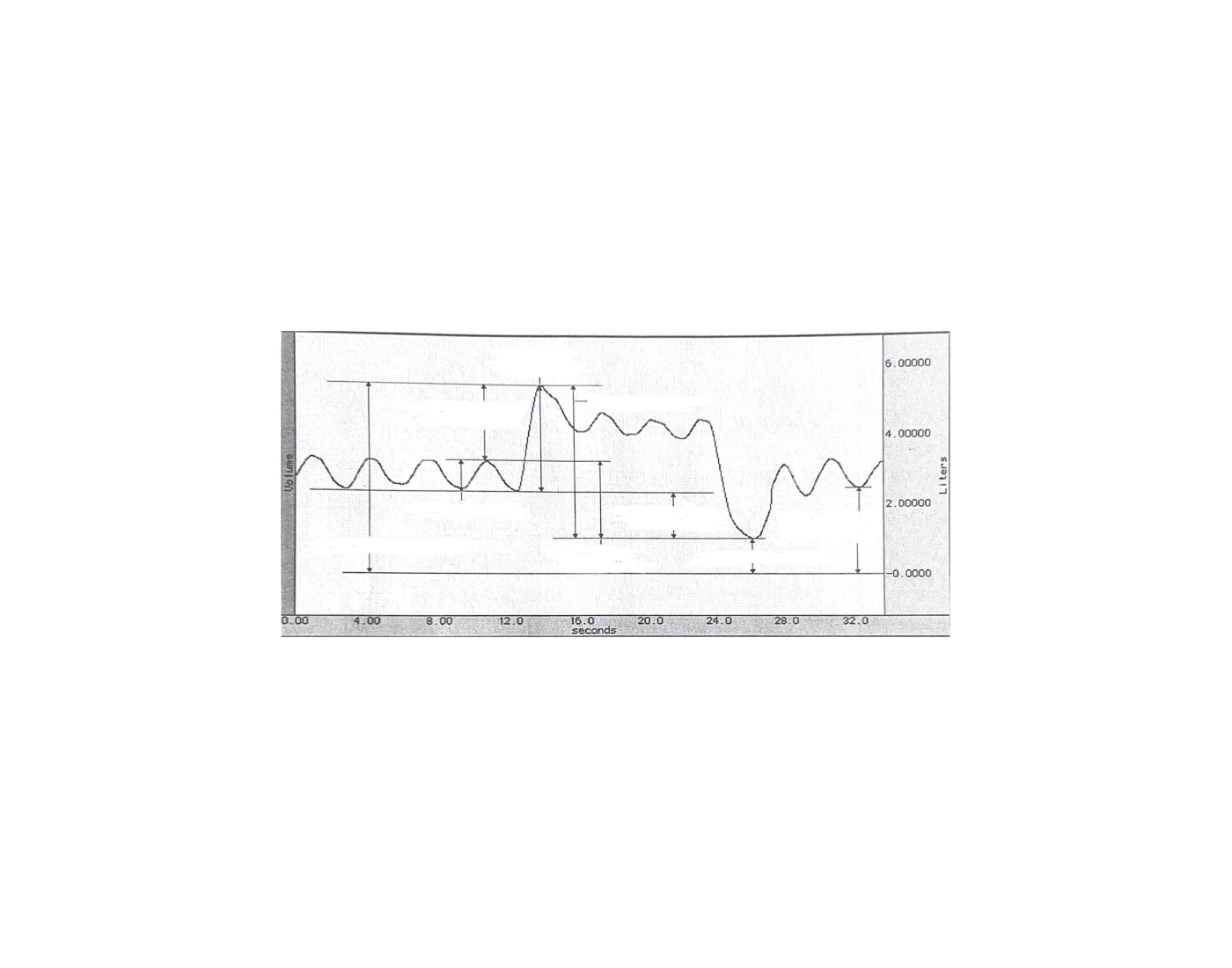 Spirogram Quiz
