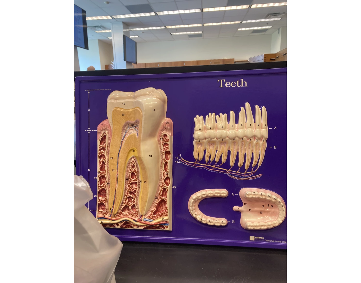 teeth lab model (for A&P) Quiz