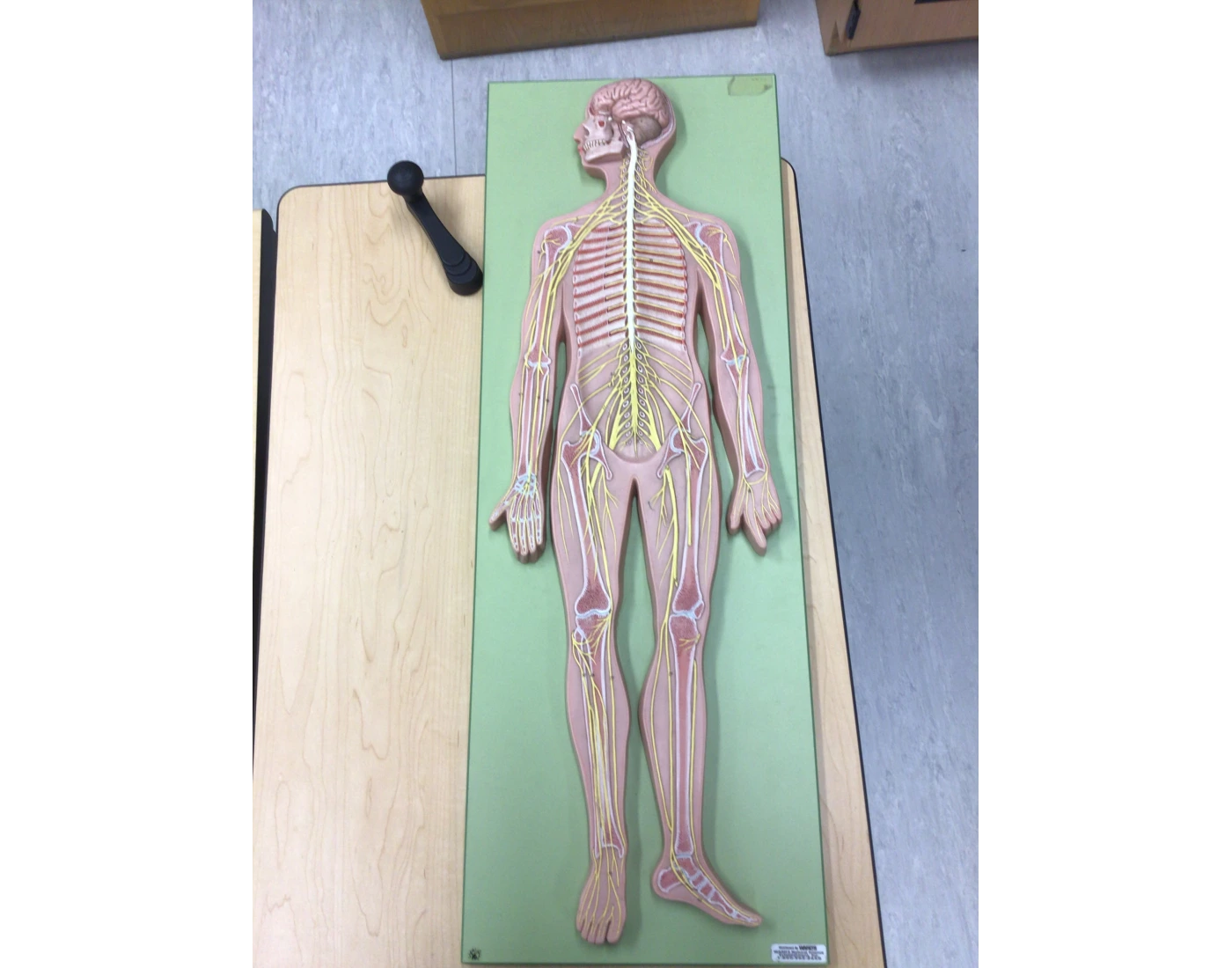 Model Of Spinal Cord With Spinal Nerves Quiz Model Of Spinal Cord With Spinal Nerves Quiz