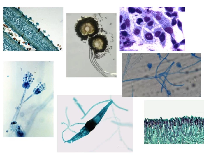 Fungi Under Microscopes Quiz