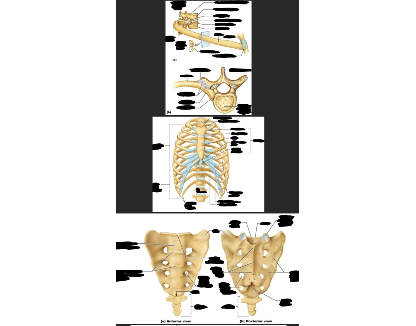 sacrum & coccyx, bony thorax(rib cage), single rib — Printable Worksheet