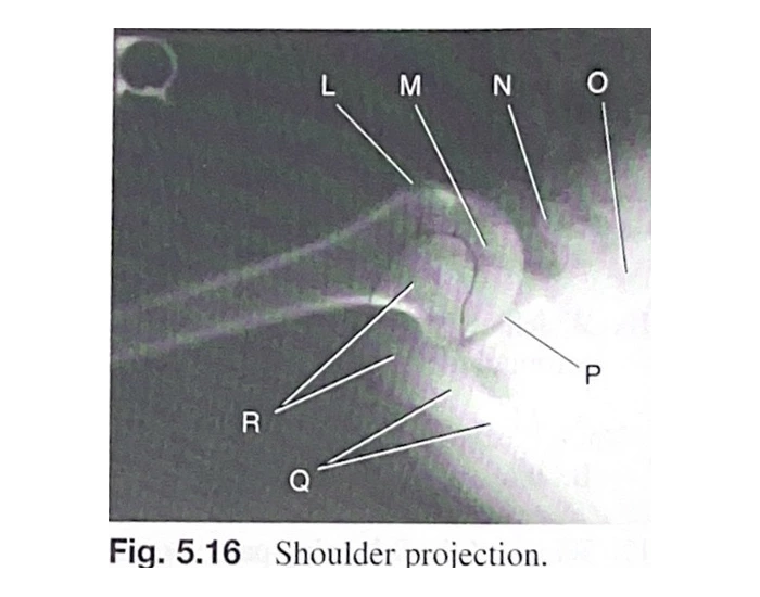 Axile Labels Axillary shoulder X-ray labeling Quiz