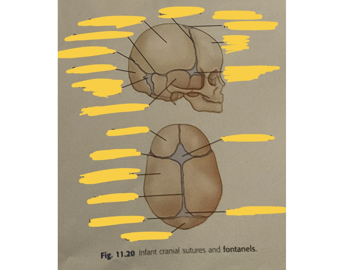 Infant cranial suture and fontanel Quiz Biology Diagrams