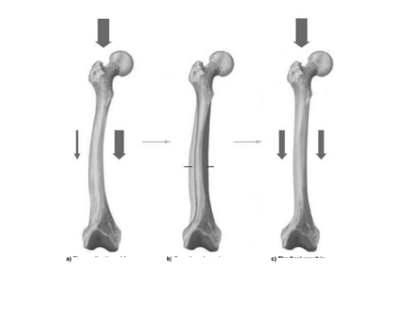HB-CH4- Bone remodeling Quiz