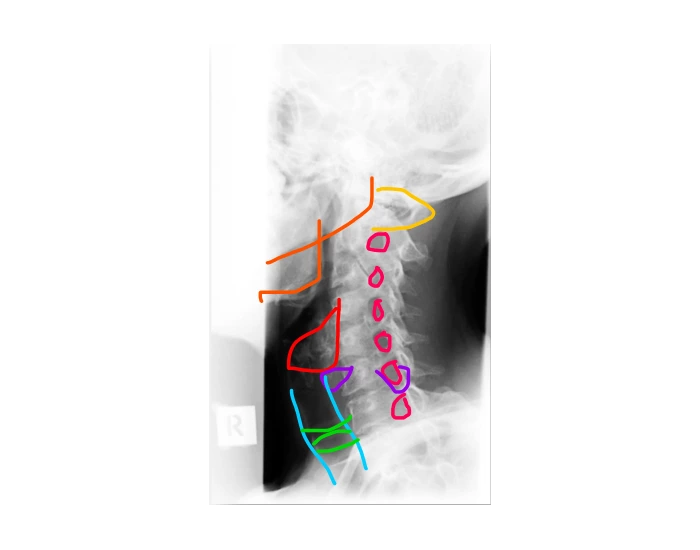 Right posterior oblique β Printable Worksheet