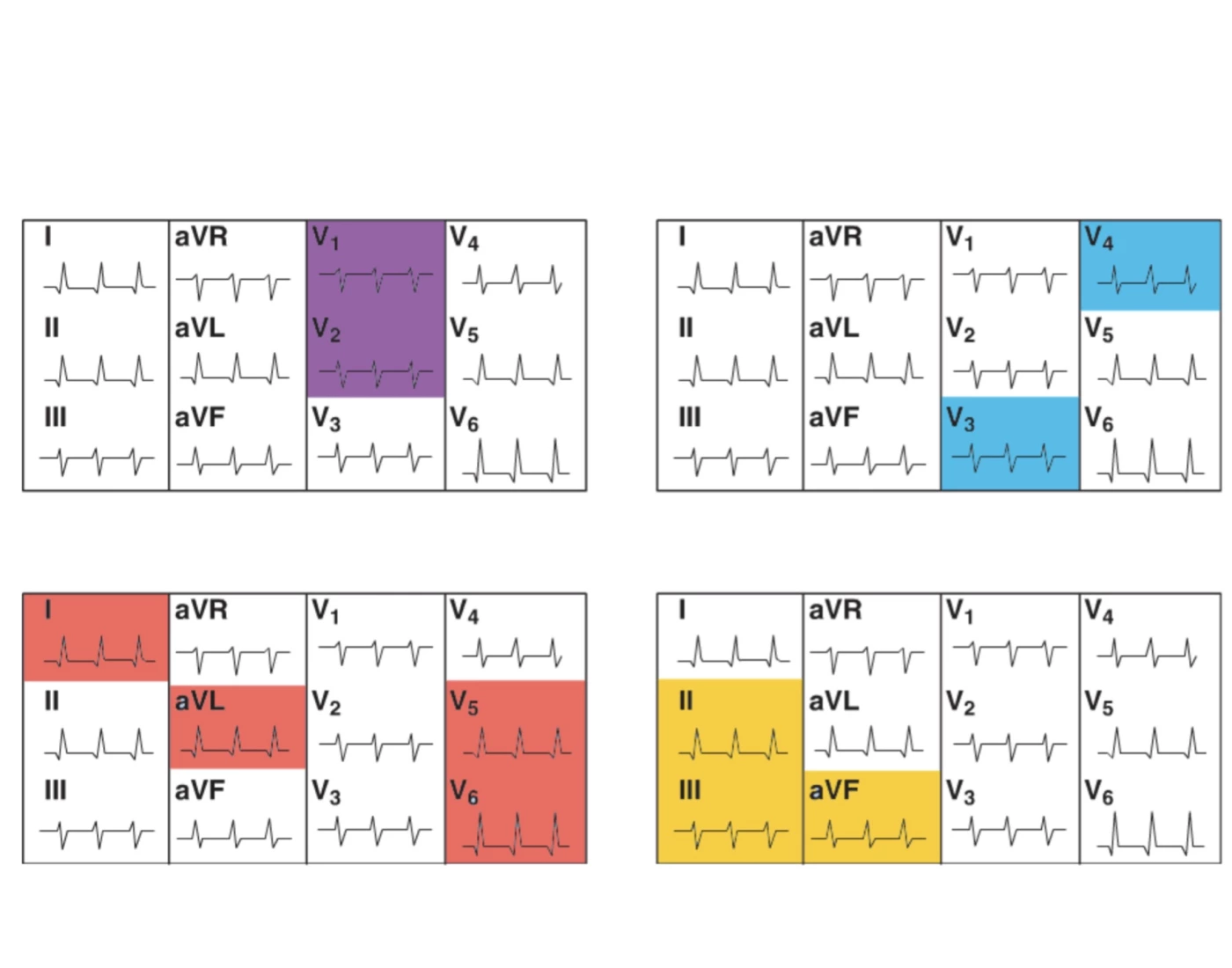 ecg-reading-quiz