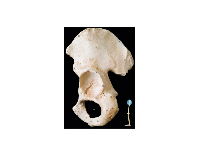 Bony Landmarks Pelvic Innominate Bone Lateral Quiz