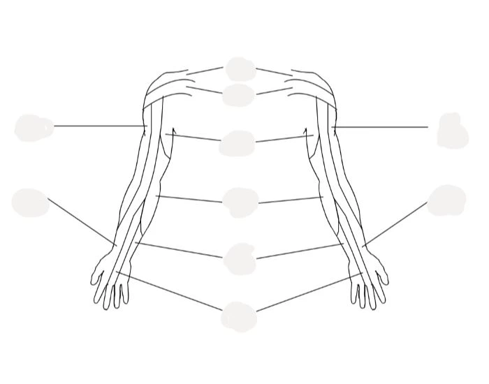Dermatome Upper Limb Printable Worksheet