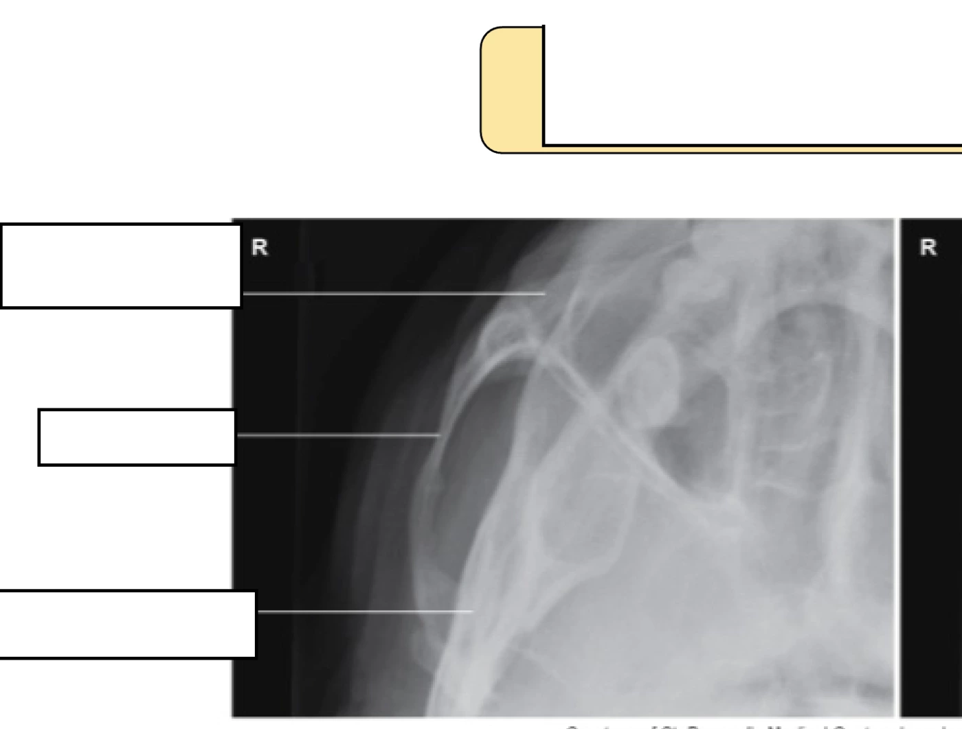 Tangential Projection Radiograph Tangential projection for zygomatic arches Quiz