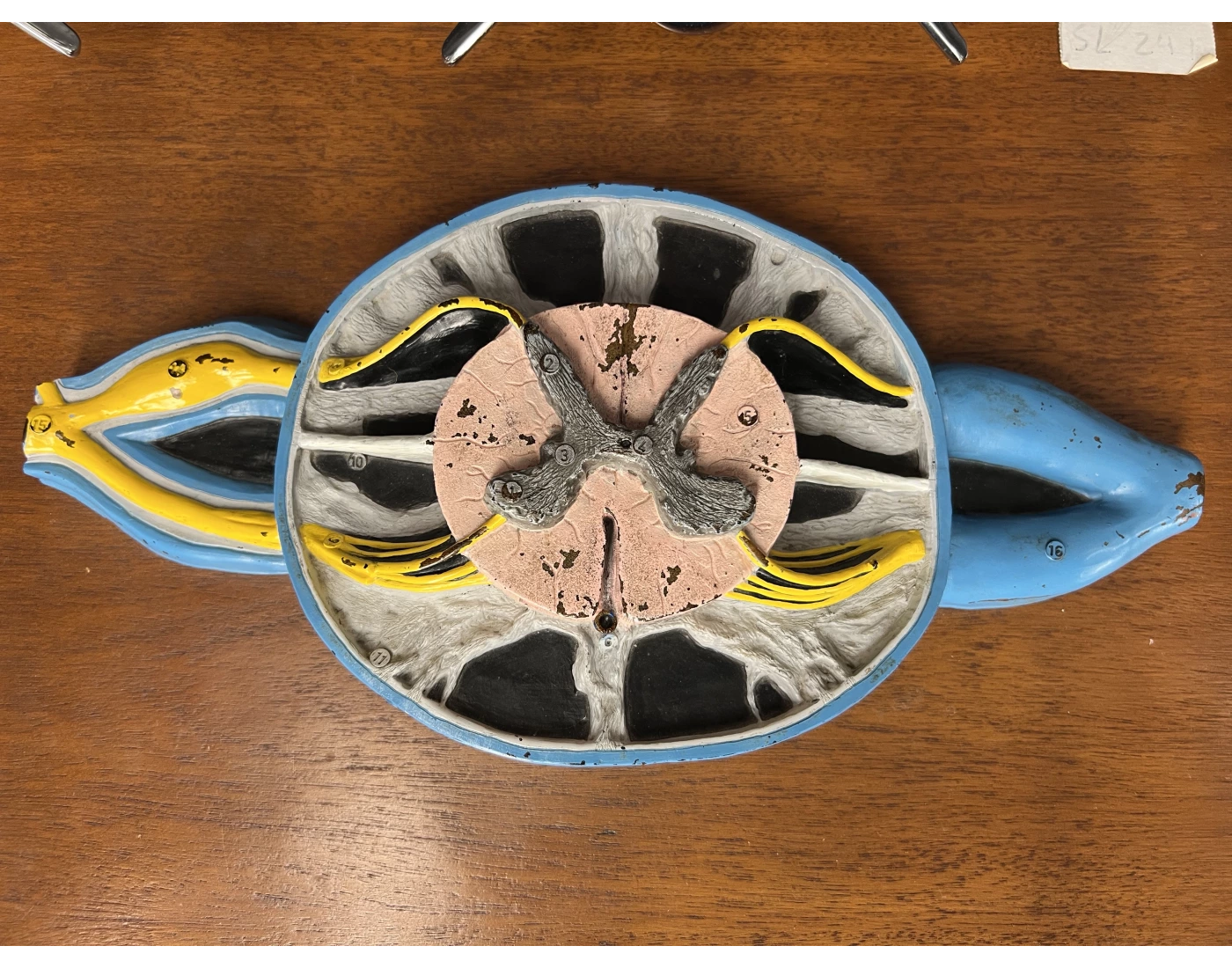 Spinal Cord Model 1 Quiz Spinal Cord Model 1 Quiz