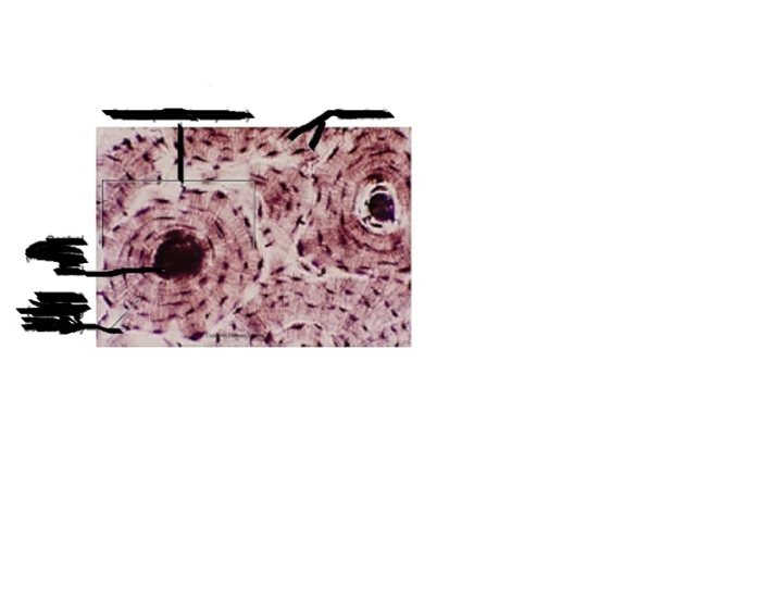 Bone Tissue Zoomed In Compact bone label zoomed in Quiz