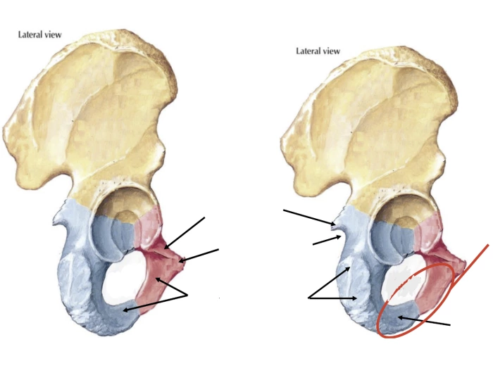 Pubis and Ischium Quiz