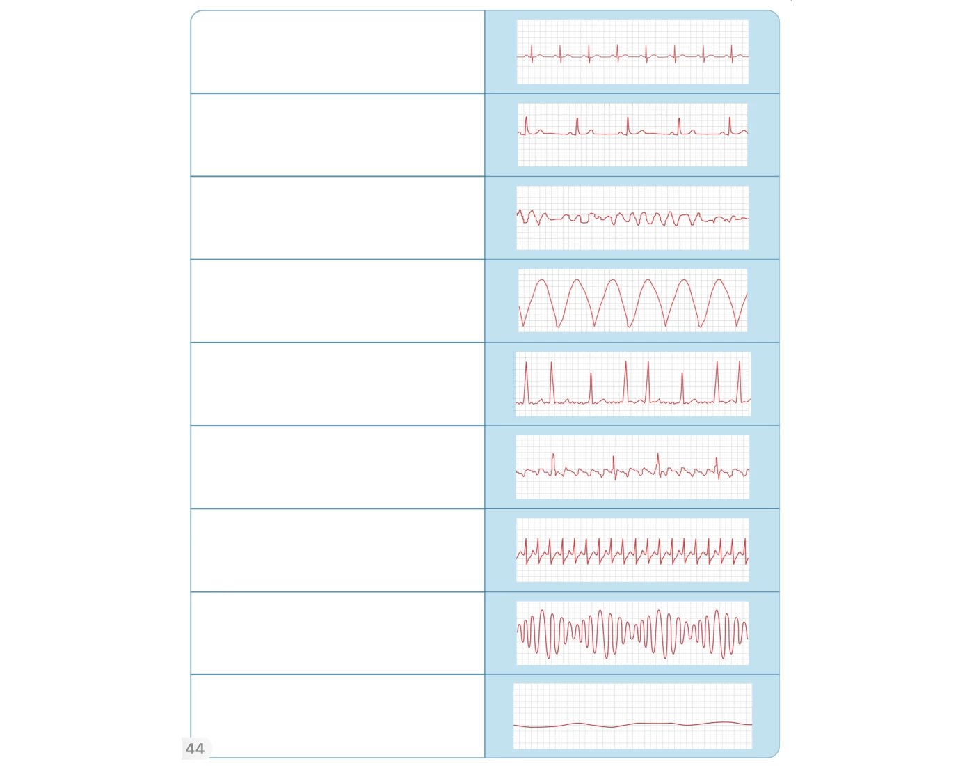 EKG STRIPS NURSING Quiz EKG STRIPS NURSING Quiz