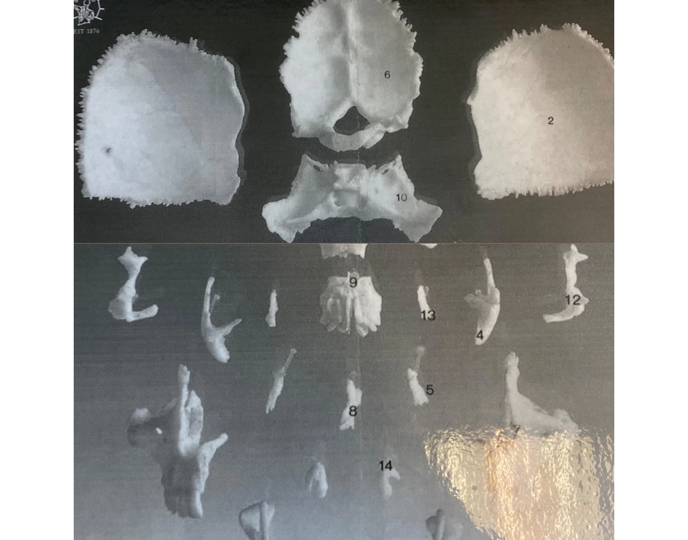 Exploding skull Quiz
