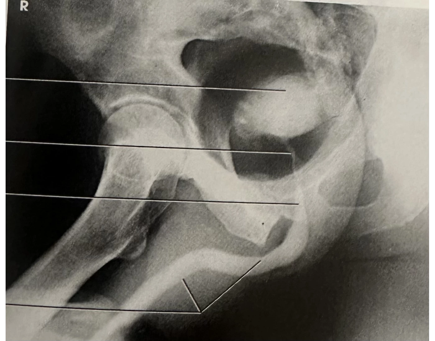 AP oblique urethra RPO Position Quiz