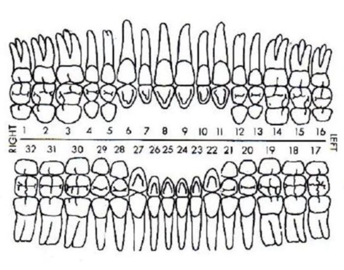 Dental Charting Quiz dental-charting-quiz