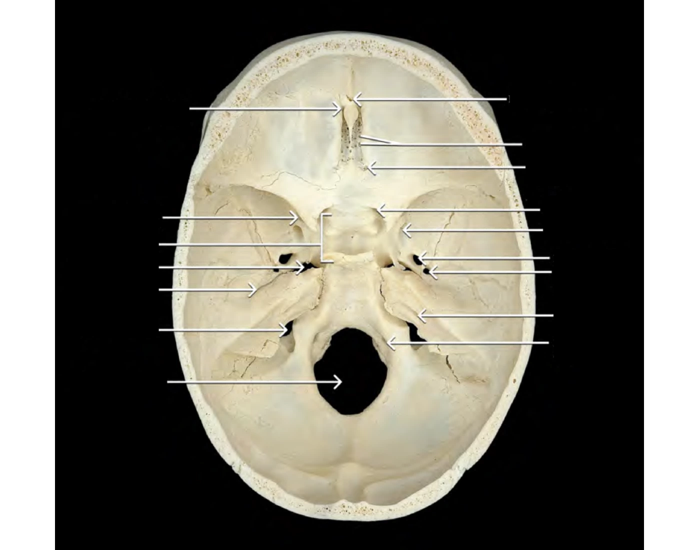 Aperatures of the skull (superior view) Quiz